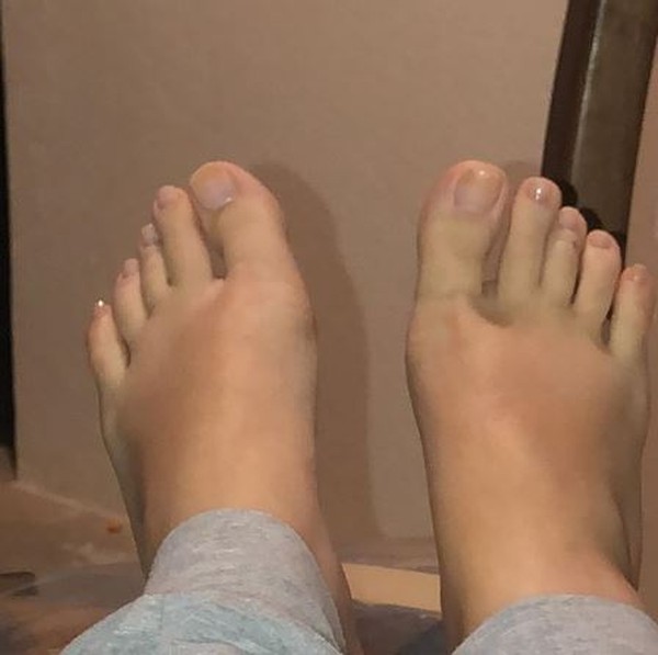 Pé de Tatá Werneck na gravidez por Reprodução/Instagram