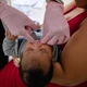 Imagem - Prefeitura de Lauro de Freitas oferece cirurgia gratuita para corrigir 'língua presa' em bebês