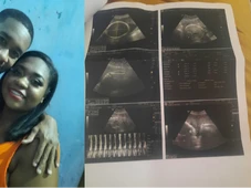 Imagem - Nasce bebê de mulher que descobriu gravidez aos 9 meses na Bahia
