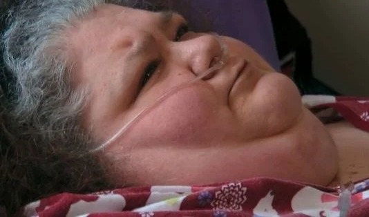 Sem sair de casa há seis anos, Joyce percebeu que a situação estava insustentável, ela procurou o Dr. Now, médico do reality show "Quilos Mortais" por Reprodução/TLC