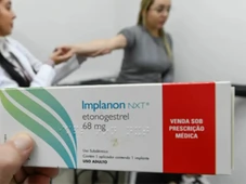 Imagem - Planos de saúde são obrigados a oferecer implante contraceptivo