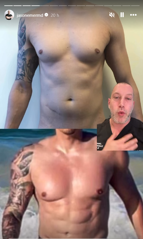 Pacientes de Jason Emer por Reprodução / Redes Sociais