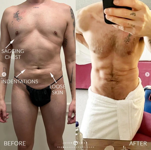 Pacientes de Jason Emer por Reprodução / Redes Sociais
