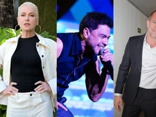 Imagem - Além de Xuxa, veja como estão outros famosos após transplante capilar