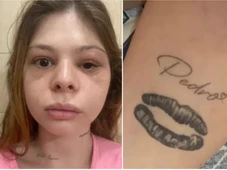 Imagem - Médica espancada por fisiculturista muda tatuagens feitas como 'prova de amor' para ele