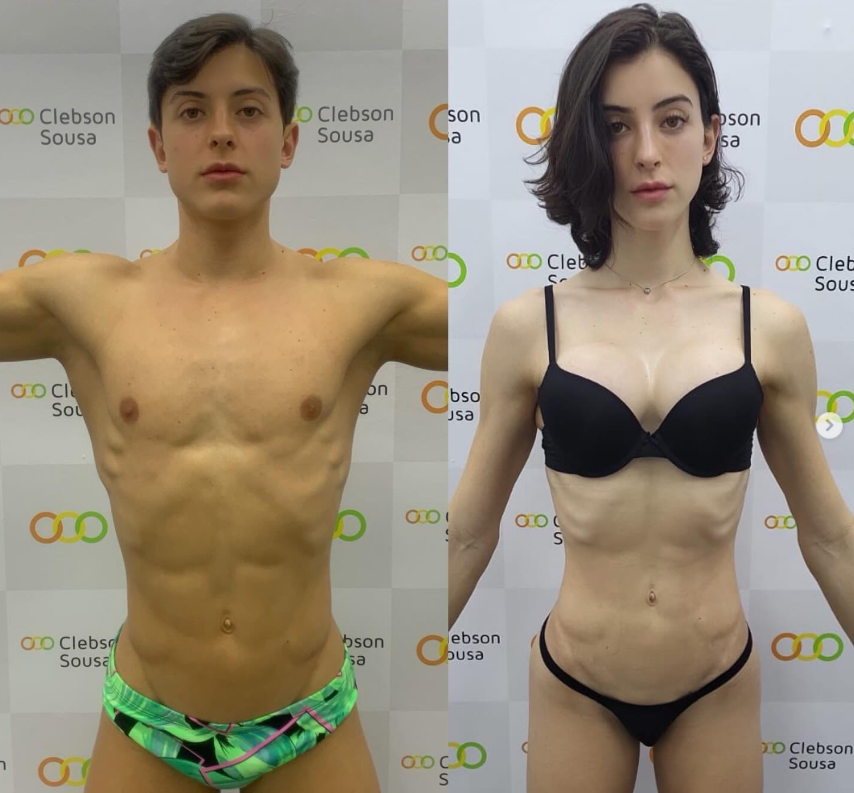 Bella Longuinho mostra resultado após transição de gênero por Reprodução / Instagram