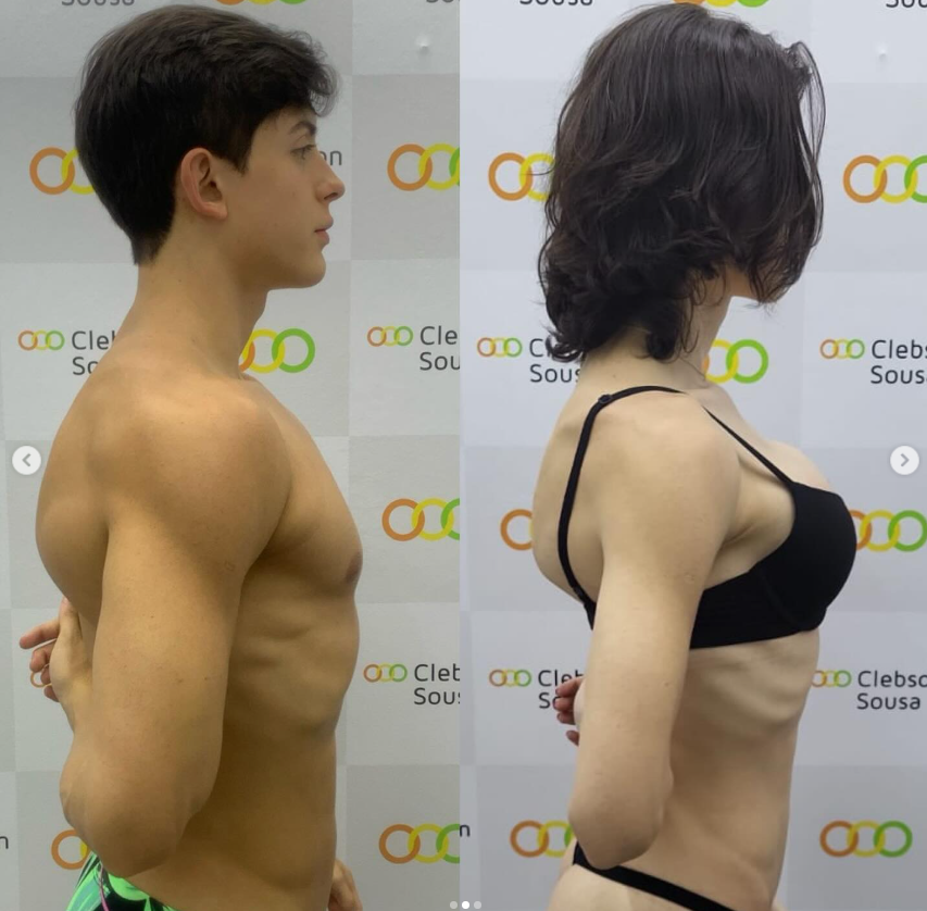 Bella Longuinho mostra resultado após transição de gênero por Reprodução / Instagram