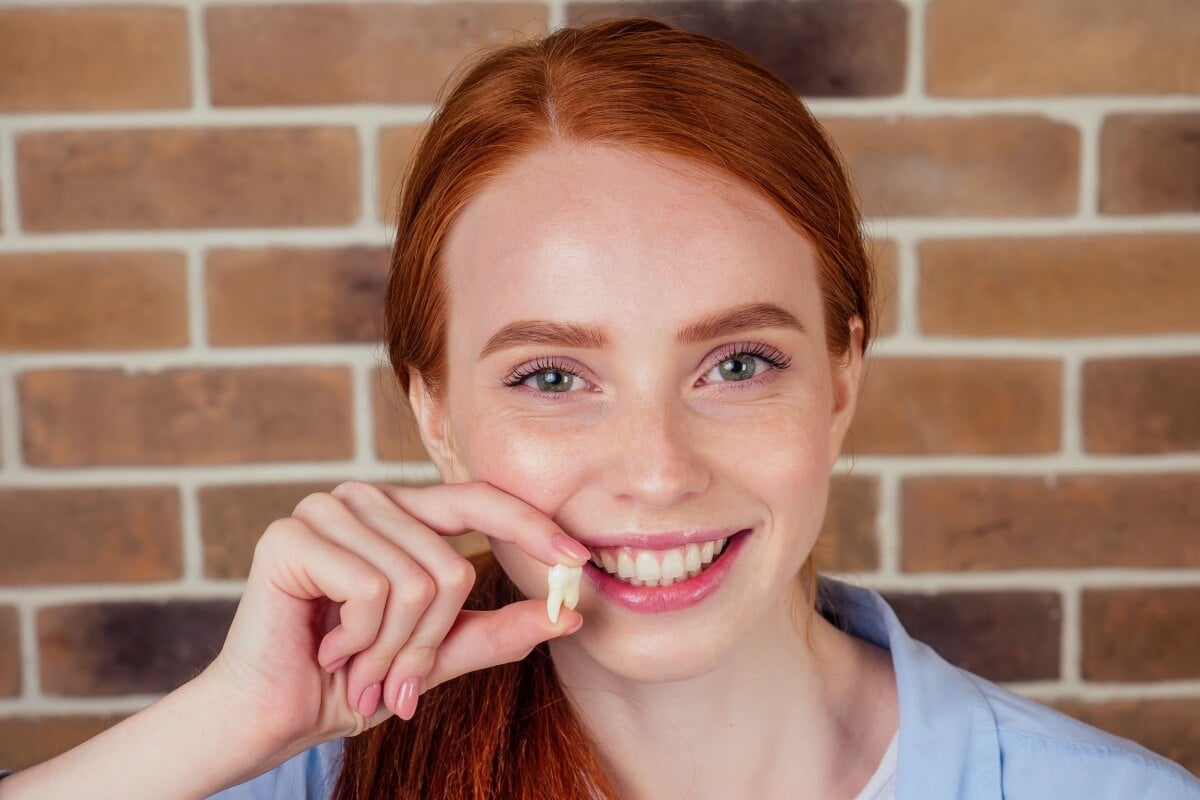 O dente do siso levanta dúvidas sobre necessidade de retirada, cuidados e recuperação (Imagem: yurakrasil | Shutterstock)