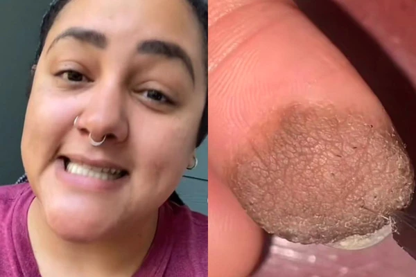 Mulher explica caso nas redes sociais