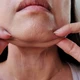 Imagem - Quer acabar com a papada? Conheça 10 dicas para perder gordura no pescoço
