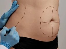 Imagem - Cirurgia plástica segura: 7 dicas essenciais antes do procedimento