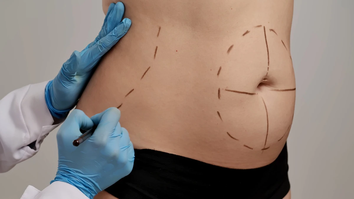 Cirurgia plástica