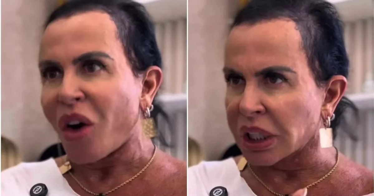 Imagem - Gretchen surpreende ao surgir com novo visual após alopecia: 'Me sinto poderosa'