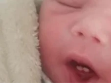 Imagem - Bebê nasce com dois dentes e surpreende família: 'Fiquei perplexo'