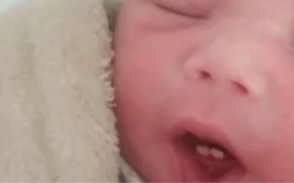 Bebê nasce com dois dentes
