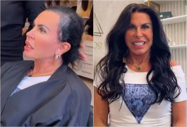Antes x Depois da transformação no visual de Gretchen por Reprodução/Instagram