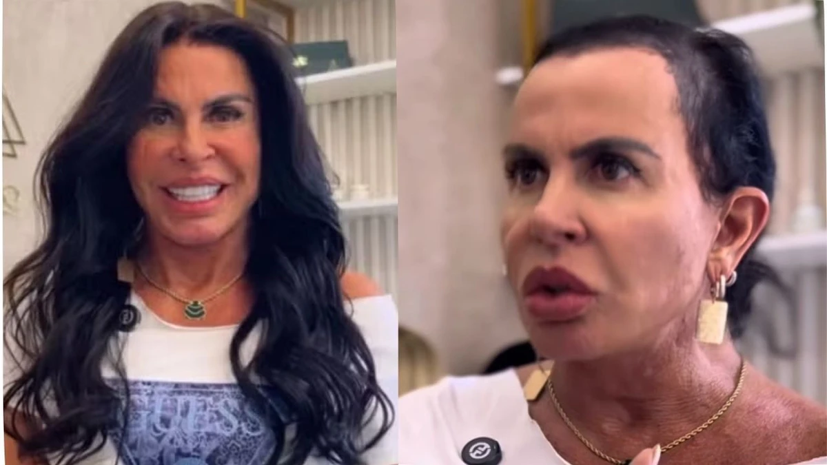 Antes x Depois da transformação no visual de Gretchen por Reprodução/Instagram