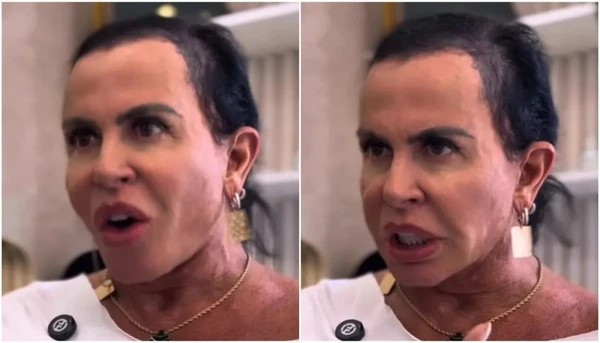Com alopecia, Gretchen passa por transformação no visual