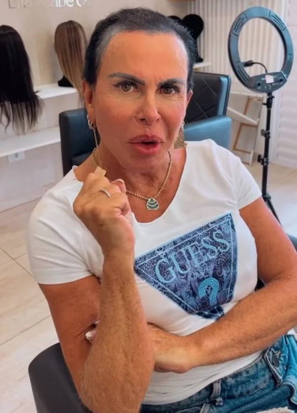 Com alopecia, Gretchen passa por transformação no visual por Reprodução/Instagram