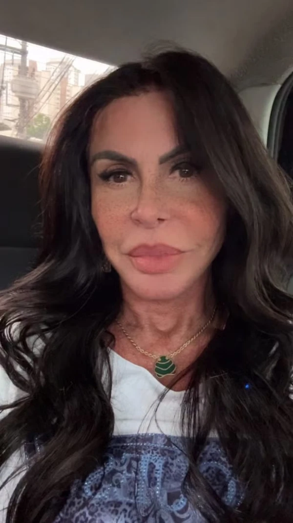Com alopecia, Gretchen passa por transformação no visual por Reprodução/Instagram