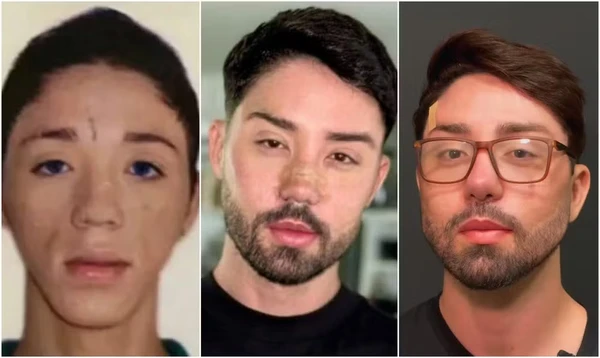 Rico Melquiades: antes e depois por Reprodução