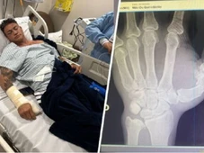 Imagem - Popó passa por cirurgia na mão e tem sangramento interno após briga generalizada