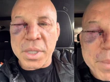 Imagem - 'Dor de cabeça que não passa', desabafa Wanderlei Silva após nocaute em briga
