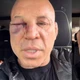 Imagem - 'Dor de cabeça que não passa', desabafa Wanderlei Silva após nocaute em briga
