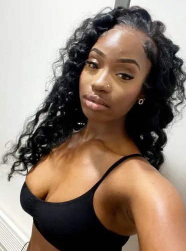 Ketia Moponda foi diagnosticada com doença meningocócica por Reprodução /  SWNS