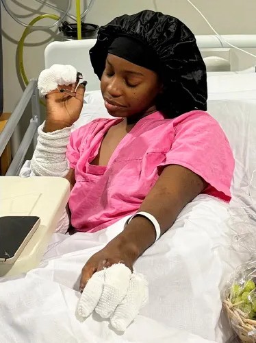 Ketia Moponda foi diagnosticada com doença meningocócica por Reprodução /  SWNS