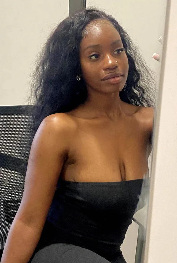 Ketia Moponda foi diagnosticada com doença meningocócica por Reprodução /  SWNS