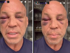 Imagem - Wanderlei Silva diz que perdeu memória e está com forte dor de cabeça após luta com Popó