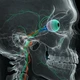 Imagem - Por que as pessoas ficam cegas quando bebem metanol?