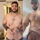 Imagem - Influenciador que perdeu 150 kg faz cirurgia para retirar 7 kg de excesso de pele e impressiona; veja transformação