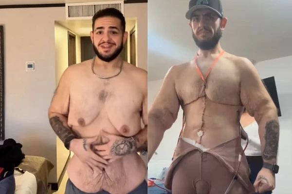 Transformação de influenciador impressionou seguidores