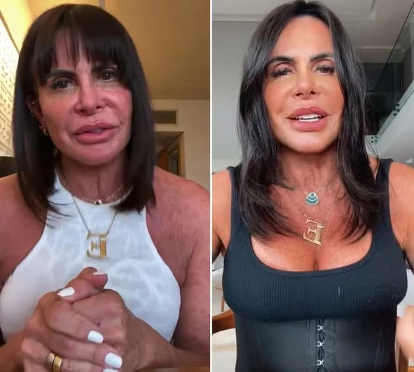Antes x Depois de Gretchen