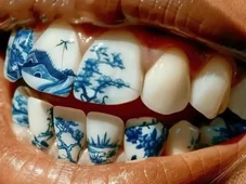 Imagem - 'Tatuagem' nos dentes vira tendência da moda entre os jovens