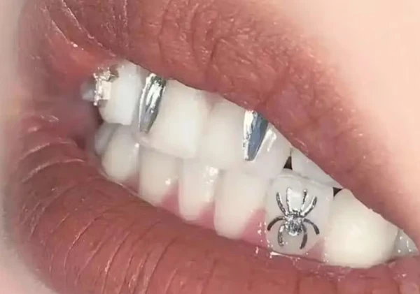 Tatuagem no dente por Reprodução