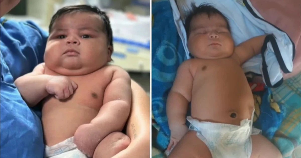 Imagem - Bebê de 6,5 kg nasce de parto normal, sofre sequelas e a mãe precisa de 55 pontos