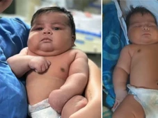 Imagem - Bebê de 6,5 kg nasce de parto normal, sofre sequelas e a mãe precisa de 55 pontos