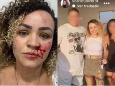 Imagem - Blogueira denuncia agressão de ex-companheiro e amiga pelas redes sociais
