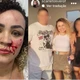 Imagem - Blogueira denuncia agressão de ex-companheiro e amiga pelas redes sociais