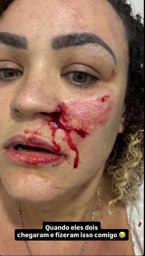 Blogueira denunciou agressão nas redes sociais por Reprodução