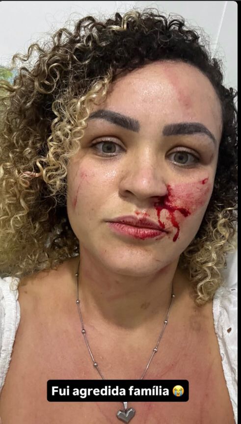 Blogueira denunciou agressão nas redes sociais por Reprodução