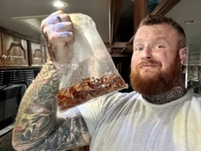 Imagem - Homem de 33 anos é internado após comer 3 kg de balas em três dias: 'Foi uma dor insuportável'