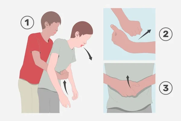  A manobra de Heimlich pode salvar vidas em casos de engasgo, aprenda como agir com segurança e rapidez. por Reprodução