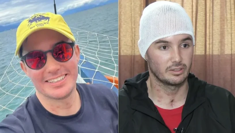 Imagem - Motoboy que ficou cego após beber uísque com metanol tem alta após 45 dias e lembra sintomas: 'Queimava'