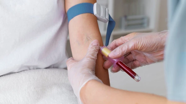 O Sistema ABO classifica o sangue humano nos grupos A, B, AB e O