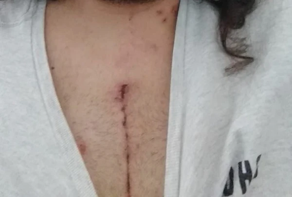 Cirurgia  por Fernanda Varela/CORREIO