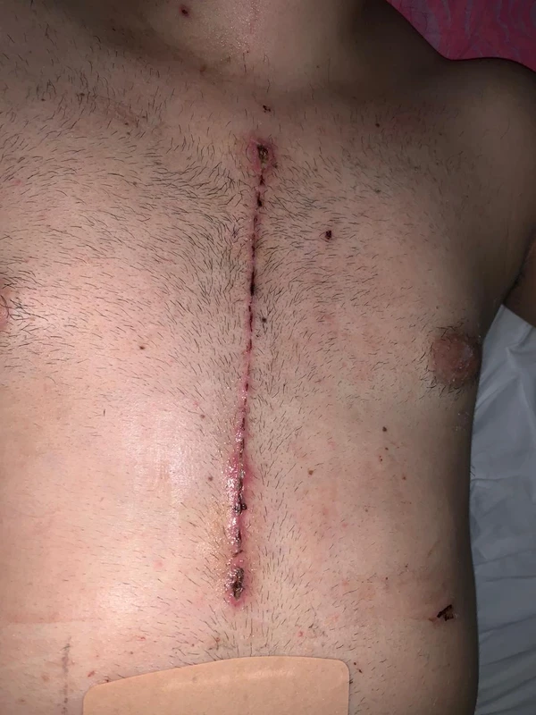 Cirurgia  por Fernanda Varela/CORREIO